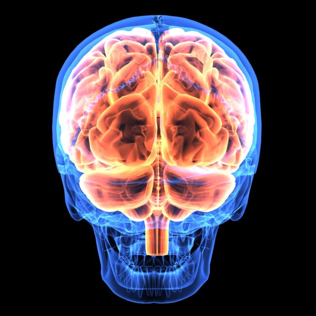 Image of right and left hemispheres of the brain